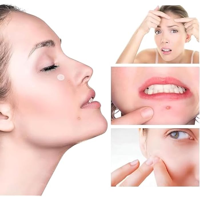 Water Spot Patches for Acne Cold Sores Skin Color Transparent Pill Sticker 8 Hours to Dry It Absorbs Bacteria in the Pimple Faster Prevent Scar…24 Pcs - Image 4